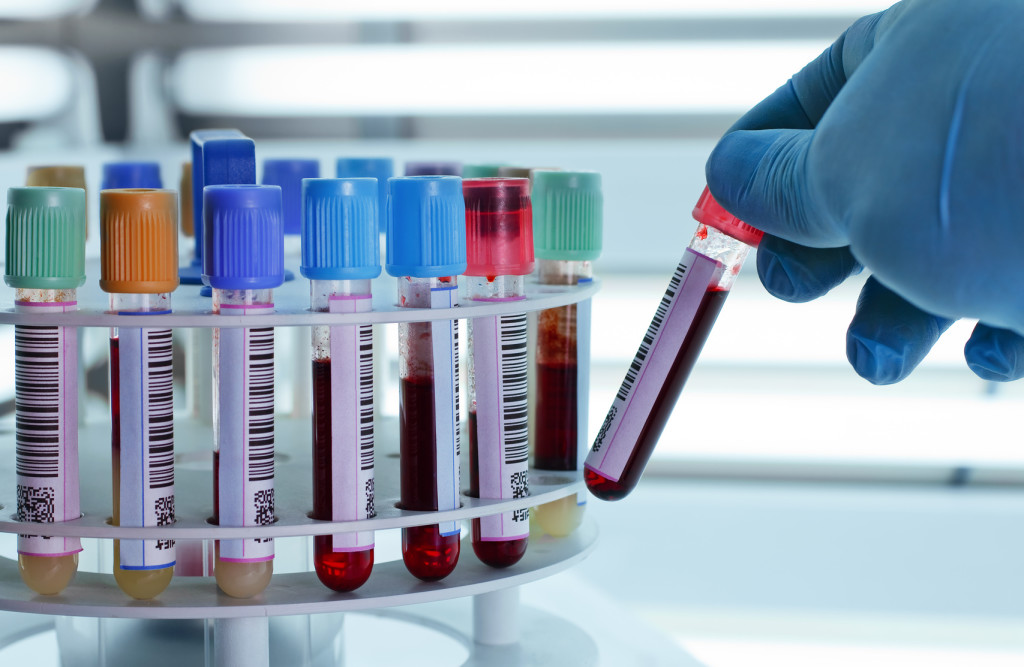 Blood tubes for centrifuging